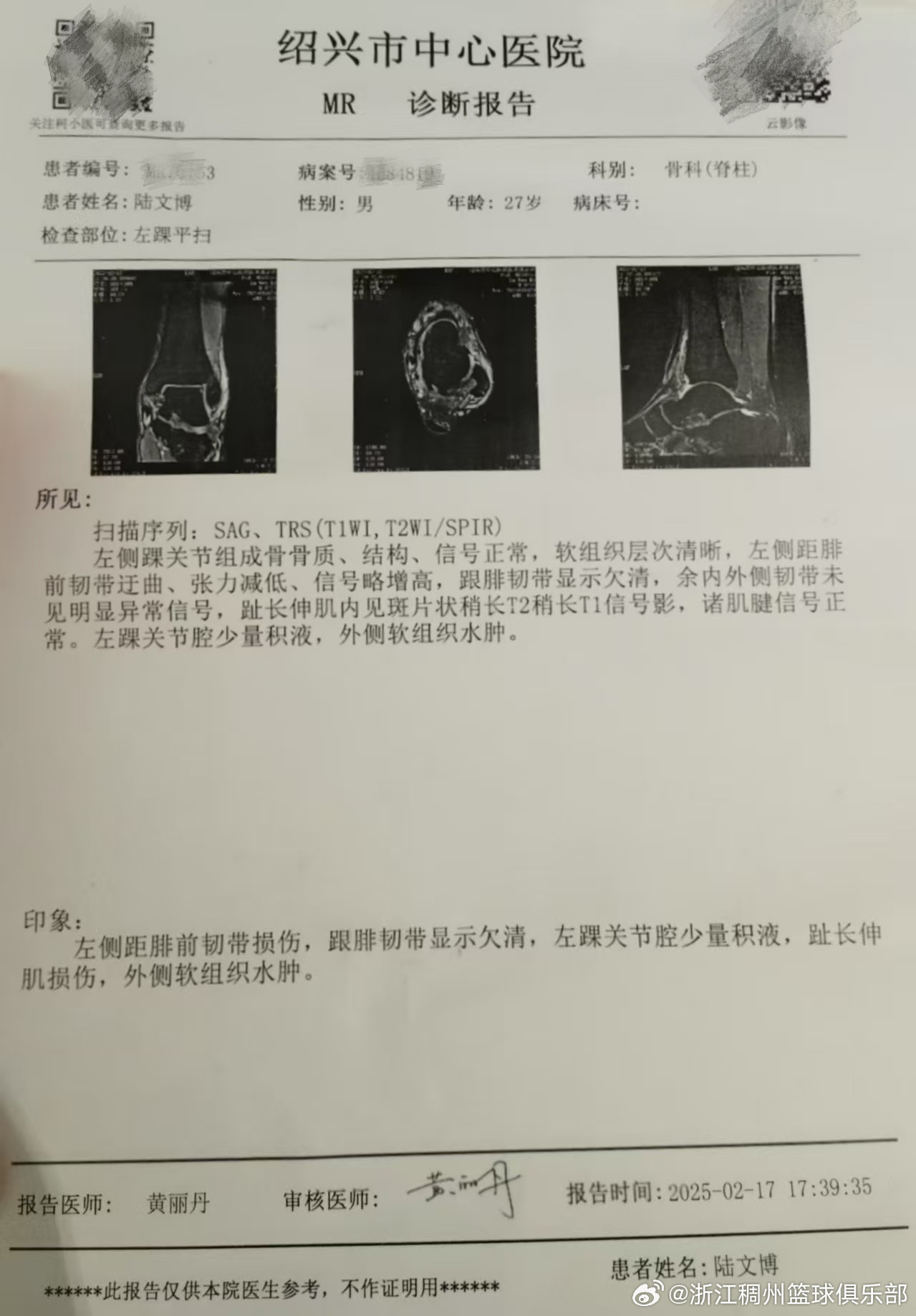 們對現代足